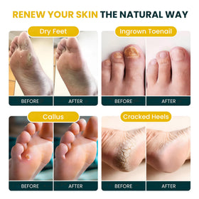 FOOT CURE pouring salts into bowl for easy preparation and mixing