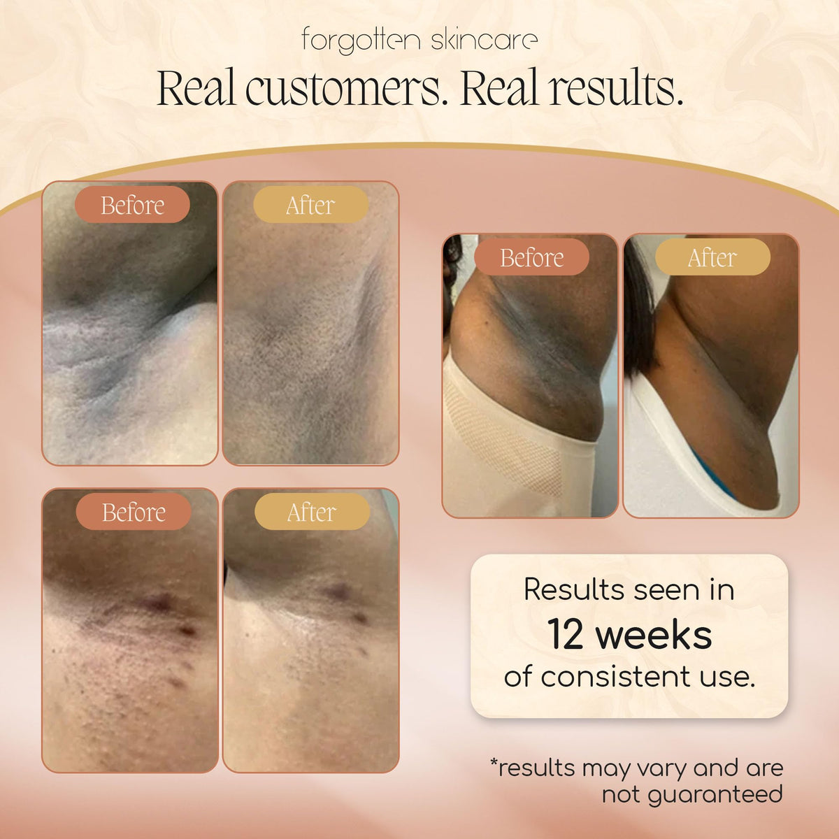 Forgotten Skincare being applied underarm demonstrating deodorizing and brightening action