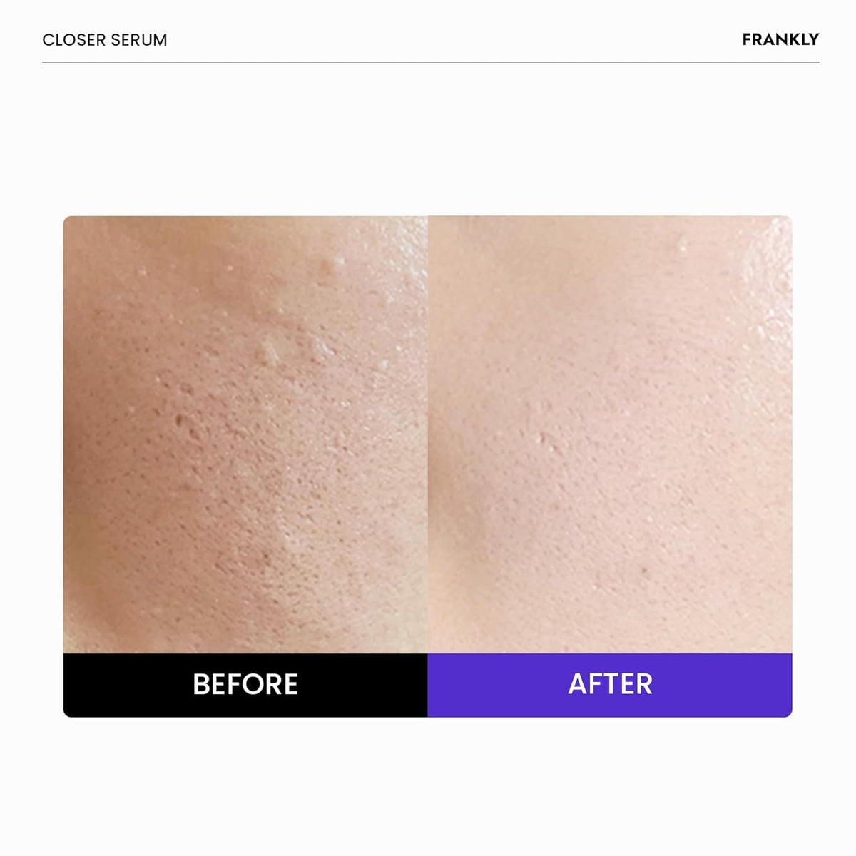 FRANKLY close-up of serum droplet texture highlighting smooth hydration benefit