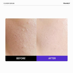 FRANKLY close-up of serum droplet texture highlighting smooth hydration benefit