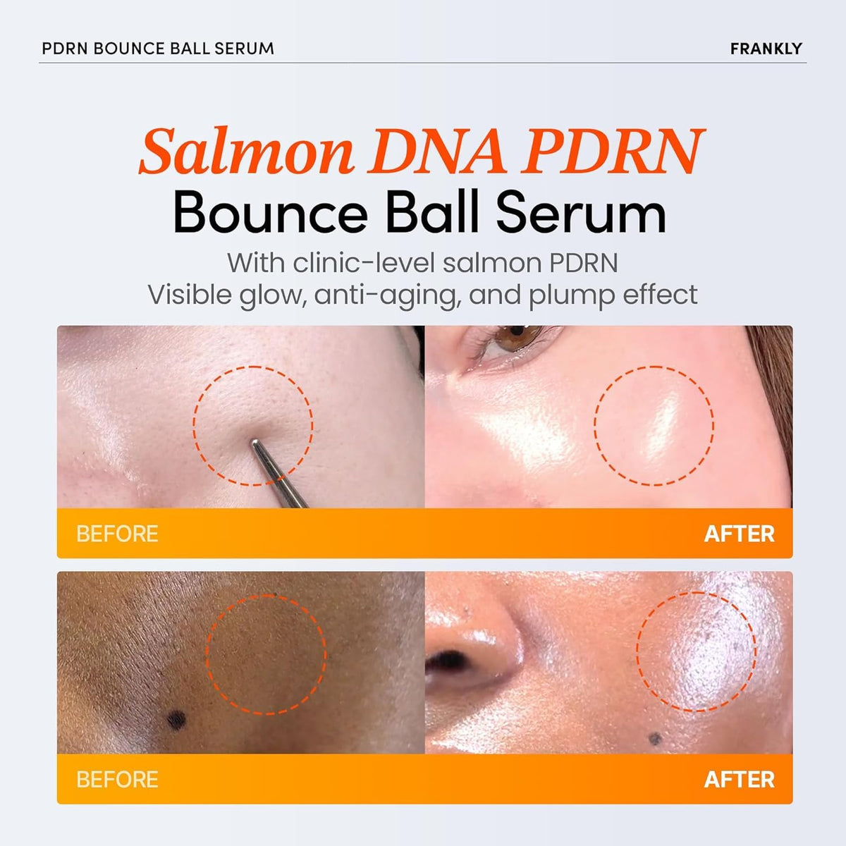FRANKLY serum drop on skin showing lightweight texture and quick absorption benefit