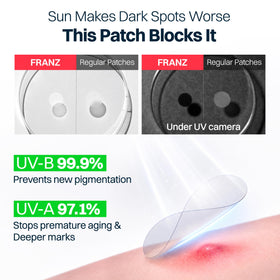 FRANZ patch applied on cheek showing protection and confidence benefit