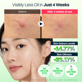 FRANZ patch worn on cheek under makeup for discreet daytime coverage