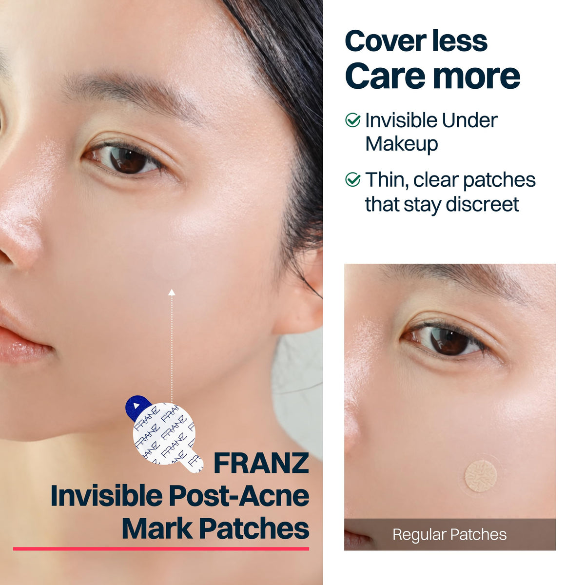 FRANZ resealable pouch open displaying multiple clear patches for travel