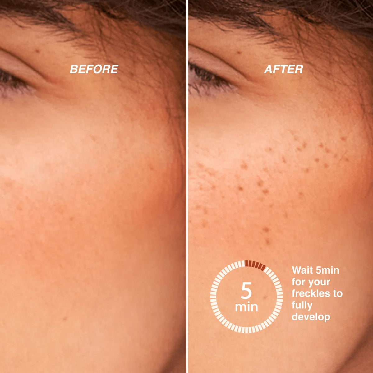 Freck Beauty pen used on nose and cheeks for realistic freckle styling