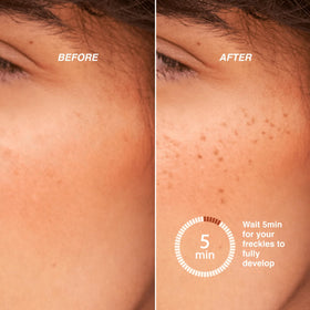 Freck Beauty pen used on nose and cheeks for realistic freckle styling