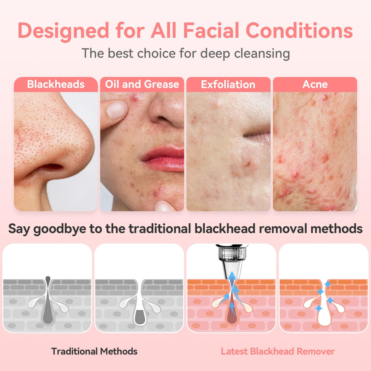 FREESHOW used on nose area illustrating precise extraction benefit