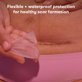 Frida Mom close-up of silicone texture highlighting soft flexibility and gentle contact benefit