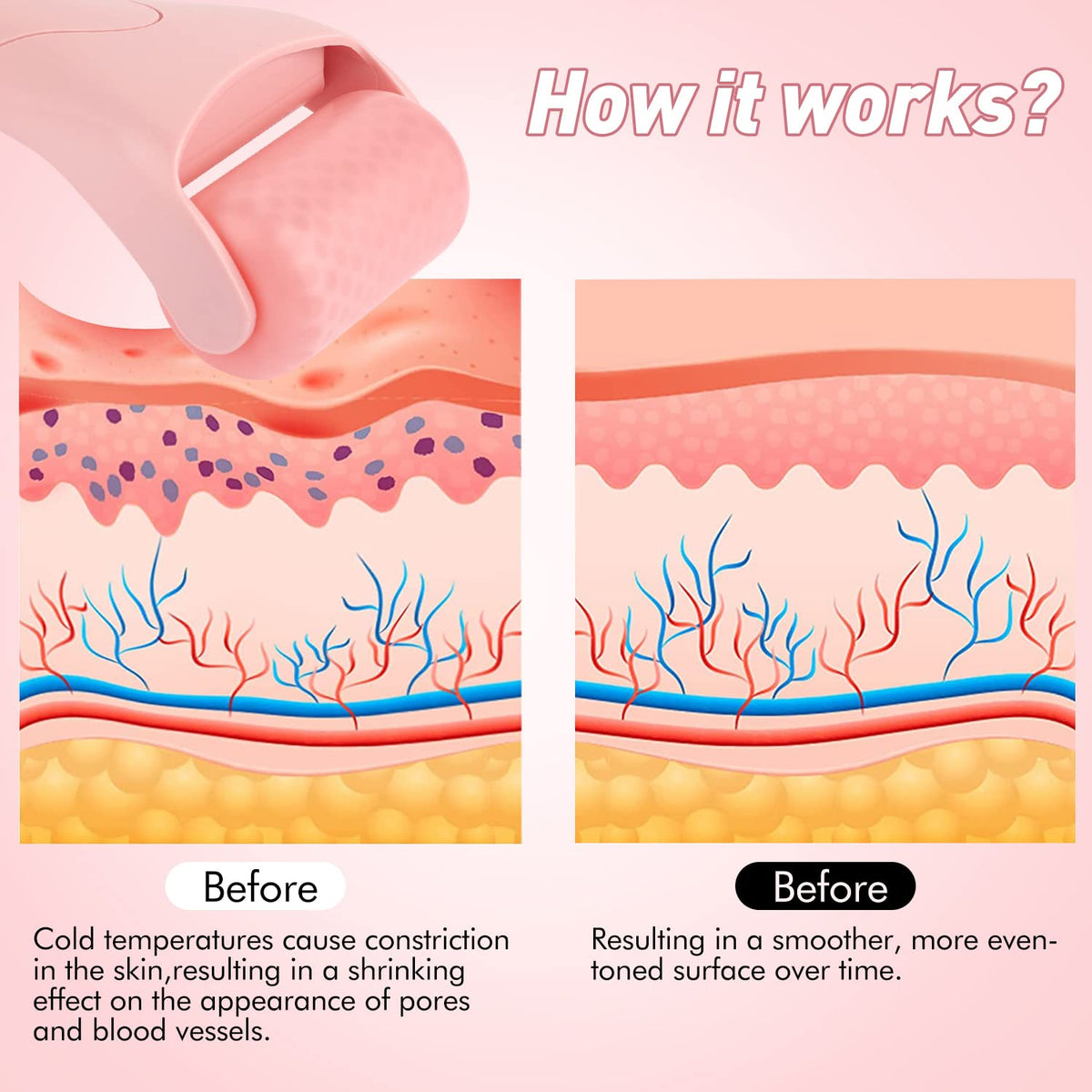 Fronnor roller in use on eye area to reduce puffiness and soothe tired skin
