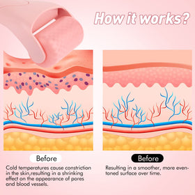 Fronnor roller in use on eye area to reduce puffiness and soothe tired skin