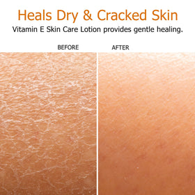 Fruit of the Earth lotion in bathroom setting suggesting daily moisturizing routine