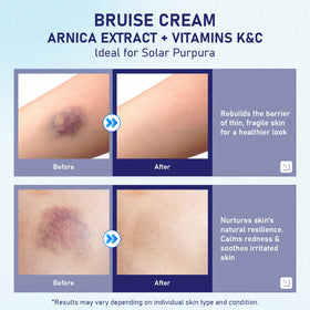 fugit applied to an older adult hand showing targeted fragile skin care