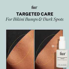 Fur serum tucked inside a travel bag indicating convenient post-removal care