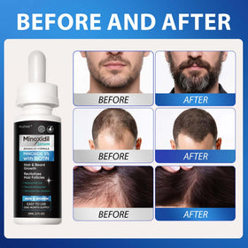 FUZYAT application on scalp demonstrating easy twice-daily use benefits