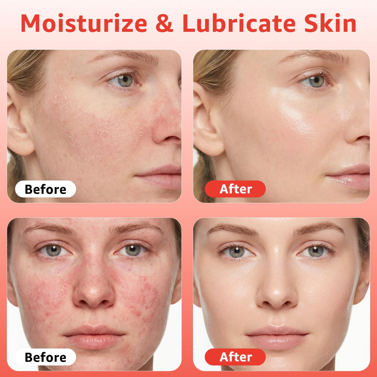 Fymiox close-up texture highlighting hyaluronic moisture boost