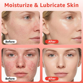 Fymiox close-up texture highlighting hyaluronic moisture boost