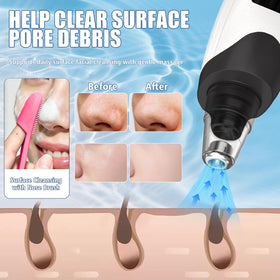 Gackoko nose brush close-up, shows soft bristles for gentle pore cleansing