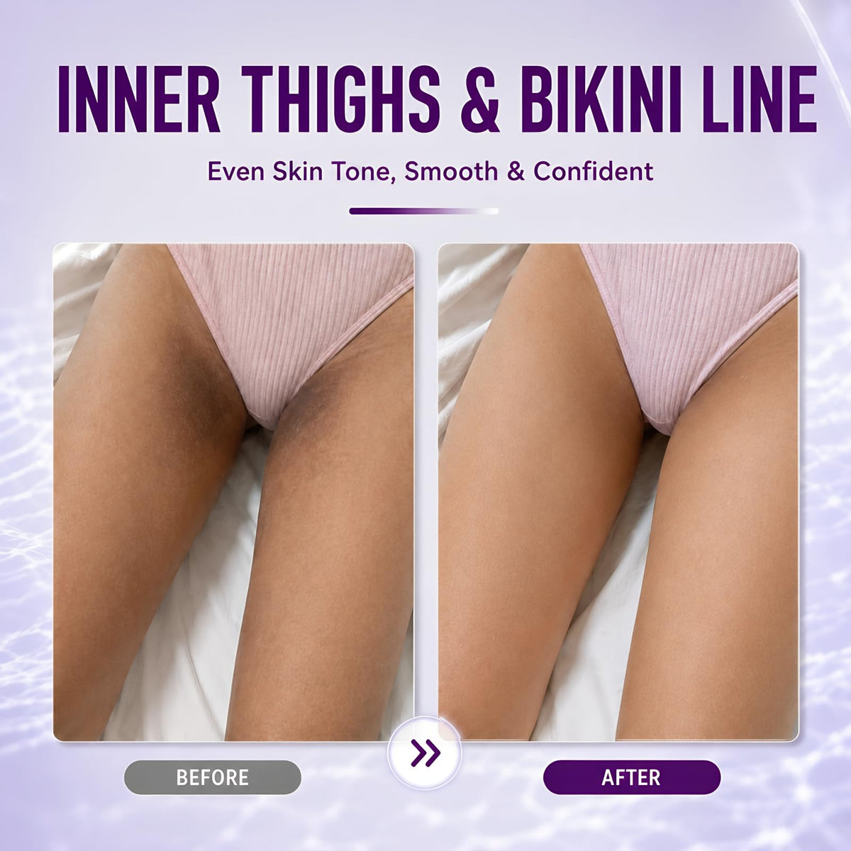 Ganrek cream applied underarm demonstrating targeted dark spot care
