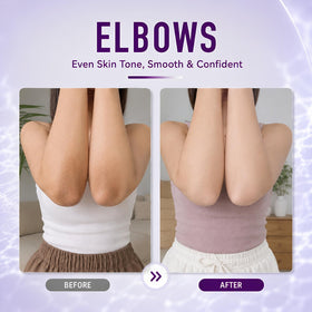 Ganrek used on elbows and knees illustrating smoothing effect