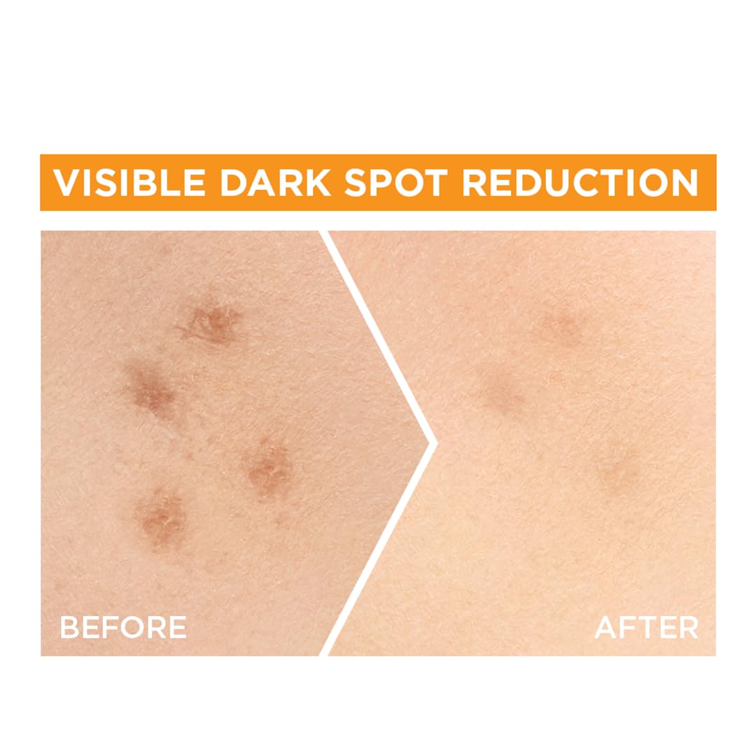Garnier lemon extracts ingredient visual indicating natural brightening support