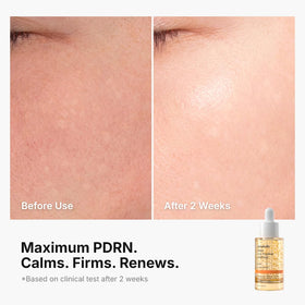 Genabelle ingredients label highlighting PDRN and multi-weight hyaluronic acids
