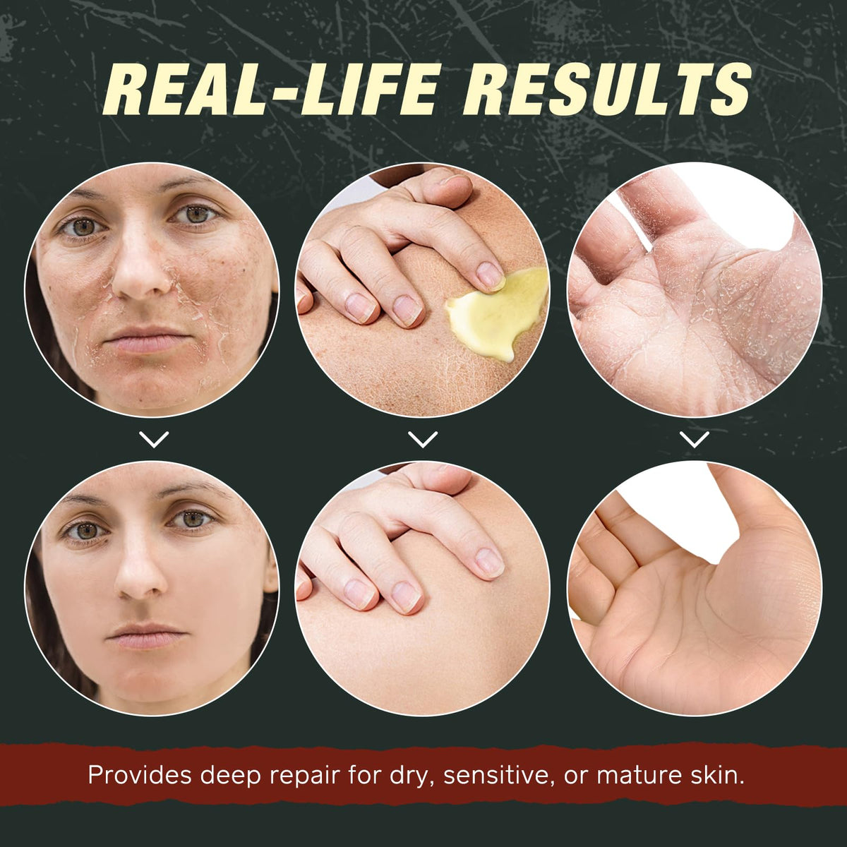 Generic brand applying balm to hand demonstrating fast absorption and skin softening
