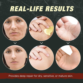 Generic brand applying balm to hand demonstrating fast absorption and skin softening