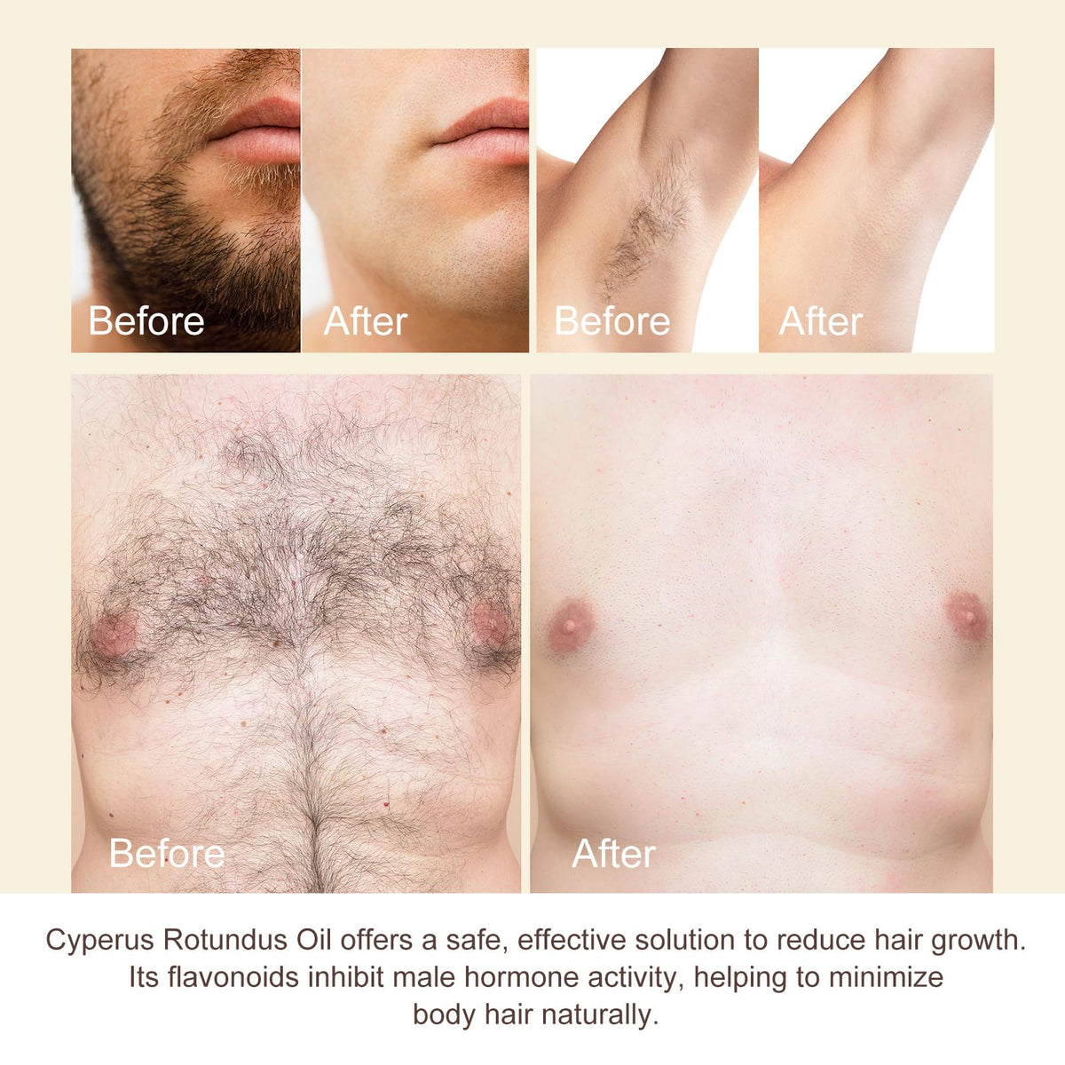 Generic Cyperus rotundus aftercare on leg showing smoother skin and reduced irritation