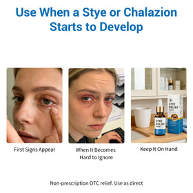 Generic illustrated before and after eyelid comfort improvement