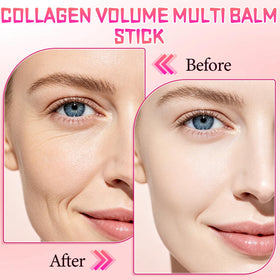 Generic PDRN smoothing balm on lips and smile lines for plumping