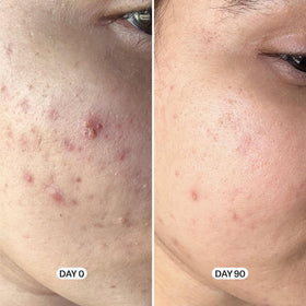 Geologie gel texture close-up illustrating lightweight exfoliating texture benefit