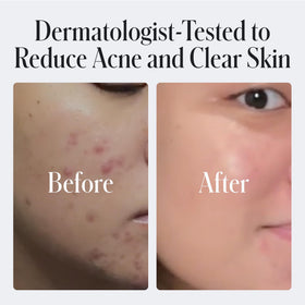 Geologie face wash in hand ready to apply to skin showing control and use