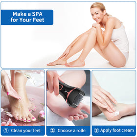 Geopu device lit up during use providing illumination for accurate callus removal