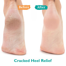 GILDEN TREE clear gel texture on fingertip demonstrating quick absorption benefit