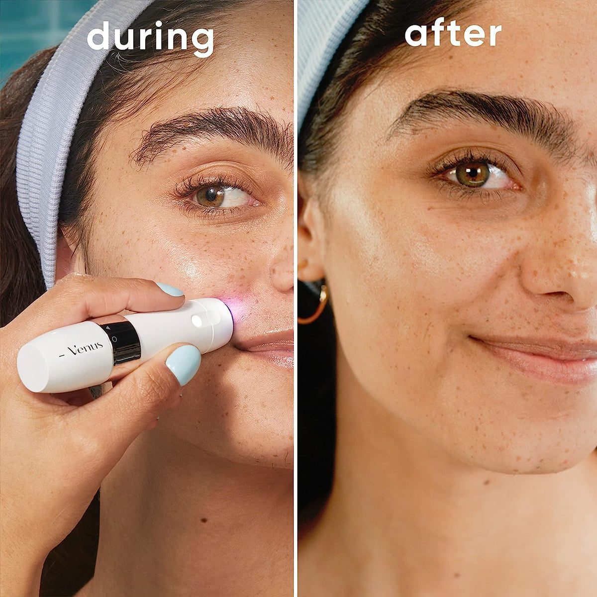 Gillette Venus smart light illuminated while trimming to reveal fine hairs for precise removal