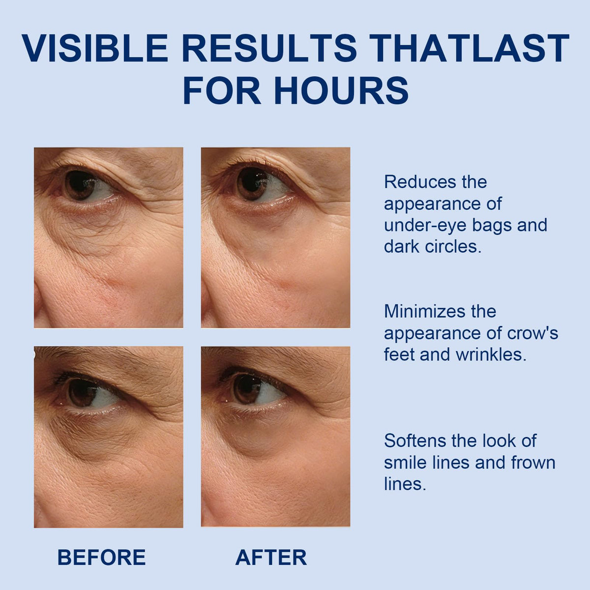 GingLePrune before and after under-eye comparison showing reduced puffiness