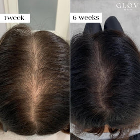 Glov Beauty ampoules arranged to show peptide hyaluronic serum benefits