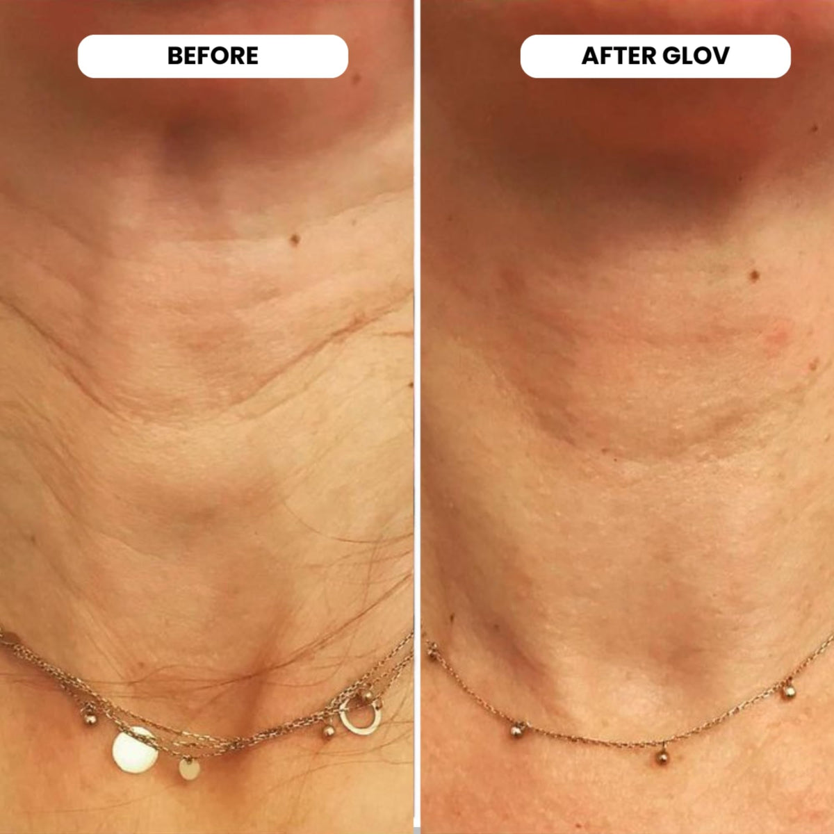 Glov Beauty serum ampoules arrayed to show hyaluronic peptide formula