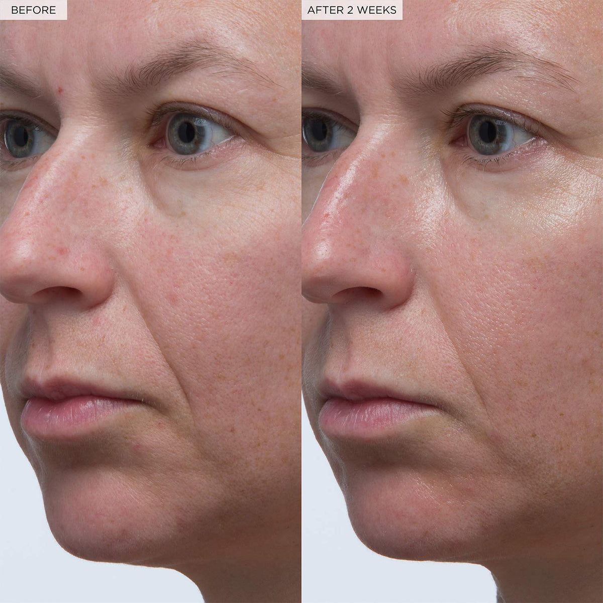 Glow Recipe model applying serum illustrating dewy, plumped skin finish