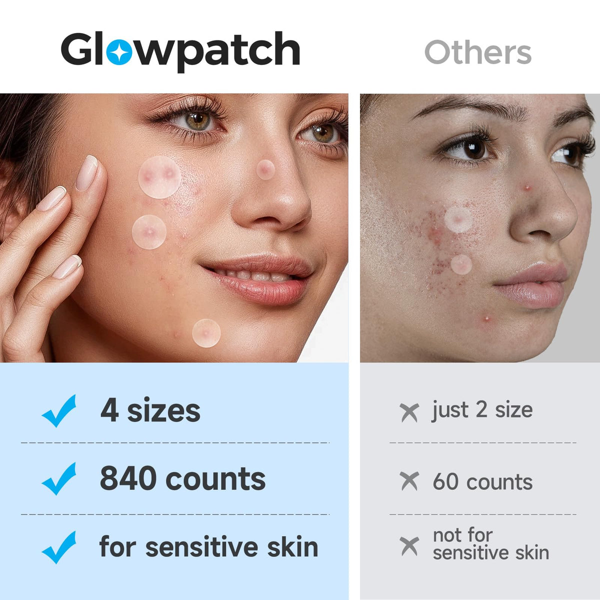 Glowpatch scale comparison in hand highlighting generous 840-patch quantity