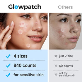 Glowpatch scale comparison in hand highlighting generous 840-patch quantity