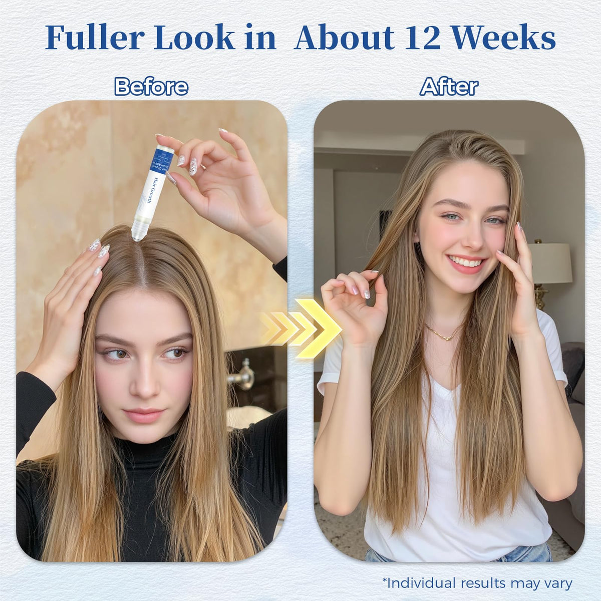 Gluvelessia roll-on applied to scalp showing targeted thinning-area treatment