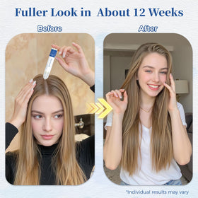 Gluvelessia roll-on applied to scalp showing targeted thinning-area treatment