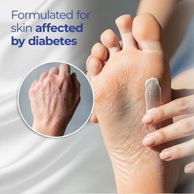 Goicoechea cream on hand demonstrating smooth application and relief