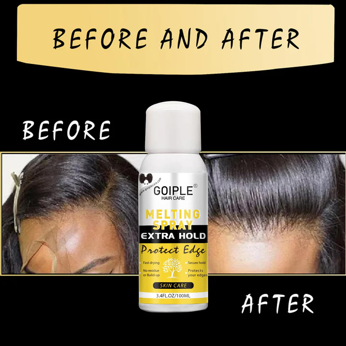 Side-by-side Goiple before and after showing improved hairline blend