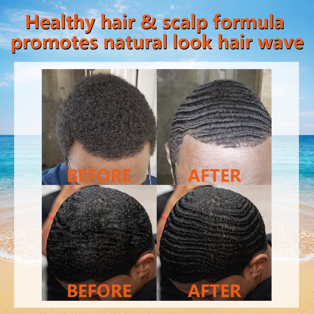 Goiple before and after crown waves showing improved wave definition benefit