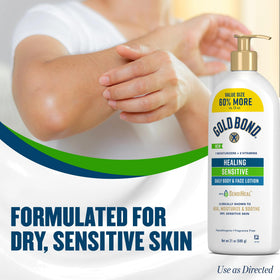 Gold Bond lotion texture on hand demonstrating lightweight, fast absorption