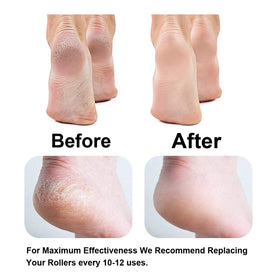 GOMINYUF before and after foot image showing smoother heels after using replacement rollers