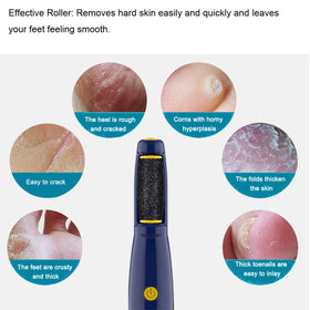 GOMINYUF roller snapped onto electronic foot file demonstrating secure fit and consistent rotation benefit