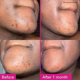 Good Molecules foamy lather on fingers showing easy application benefit